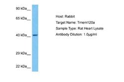 TMEM120A Rabbit anti-Rat, Polyclonal, Novus Biologicals 0.1 mL | Buy Online | Novus Biologicals | Fisher Scientific